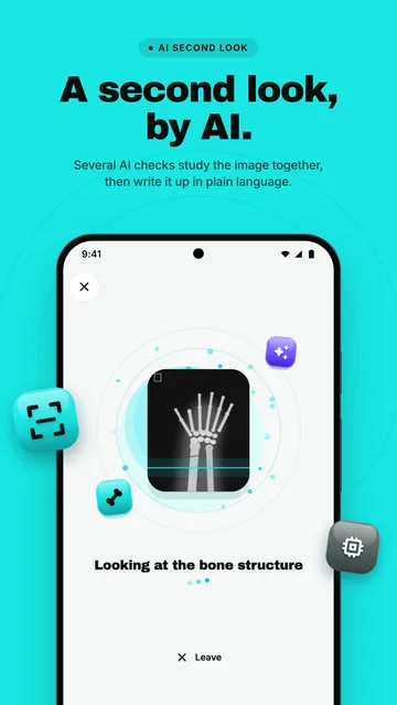 The AI looking at the bone structure of the X-ray