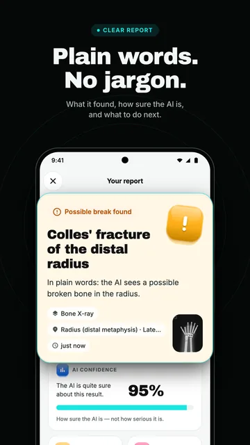 A report headline, Possible break found, explained in plain words, with the AI's confidence
